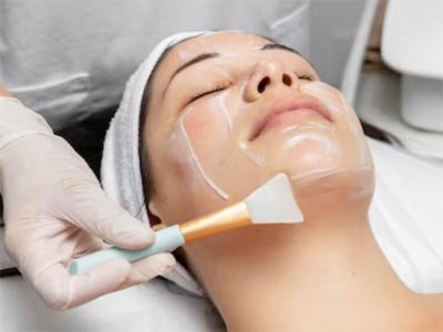 Chemical peel